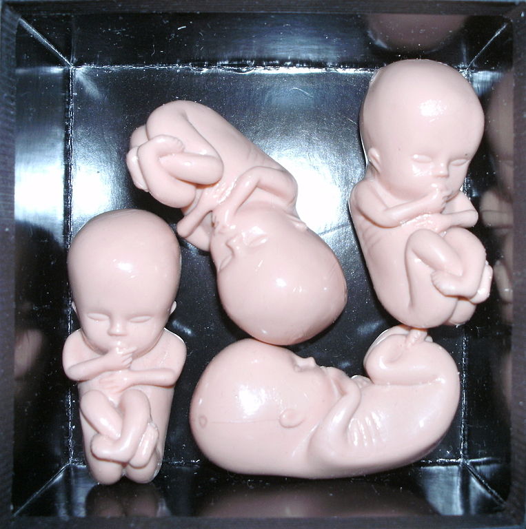 Models of fetuses at about 10 weeks