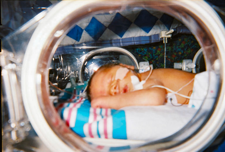 An infant in an incubator
